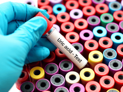 Blood test price in Pakistan